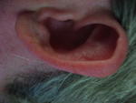 dsr-left-ear.JPG